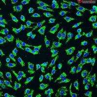 人脐动脉内皮细胞 HUAEC (Sciencell进口)