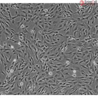 人脑血管周细胞