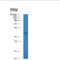 人ALKBH3重组蛋白