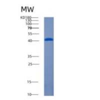 人两性蛋白诱导蛋白2重组蛋白