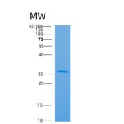 人肌动蛋白相关蛋白2/3复合体亚基2(ARPC2)重组蛋白