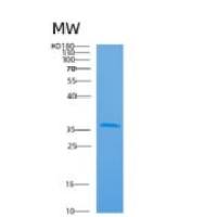 人肌动蛋白相关蛋白2/3复合体亚基2(ARPC2)重组蛋白