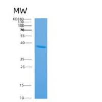 大肠杆菌ansA重组蛋白