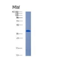小鼠血管生成素相关蛋白7重组蛋白
