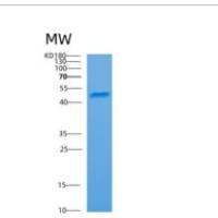 人细胞骨架活性调节蛋白(ARC)重组蛋白