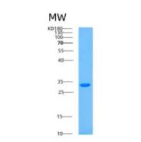 人ASB13重组蛋白