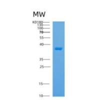 人载脂蛋白H(APOH)重组蛋白