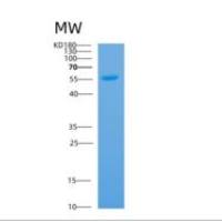 人膜联蛋白A11(ANXA11)重组蛋白