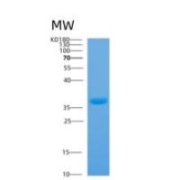 人膜联蛋白A5(ANXA5)重组蛋白