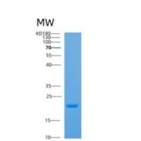 人衔接因子相关蛋白复合体1σ2(AP1s2)重组蛋白