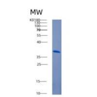 人膜联蛋白A3(ANXA3)重组蛋白