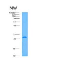 人ASF1A重组蛋白