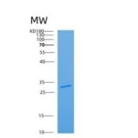 人ARMC10重组蛋白