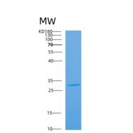 小鼠炭疽热毒素受体2(ANTXR2)重组蛋白重组蛋白