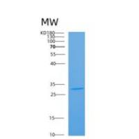 小鼠炭疽热毒素受体2(ANTXR2)重组蛋白重组蛋白