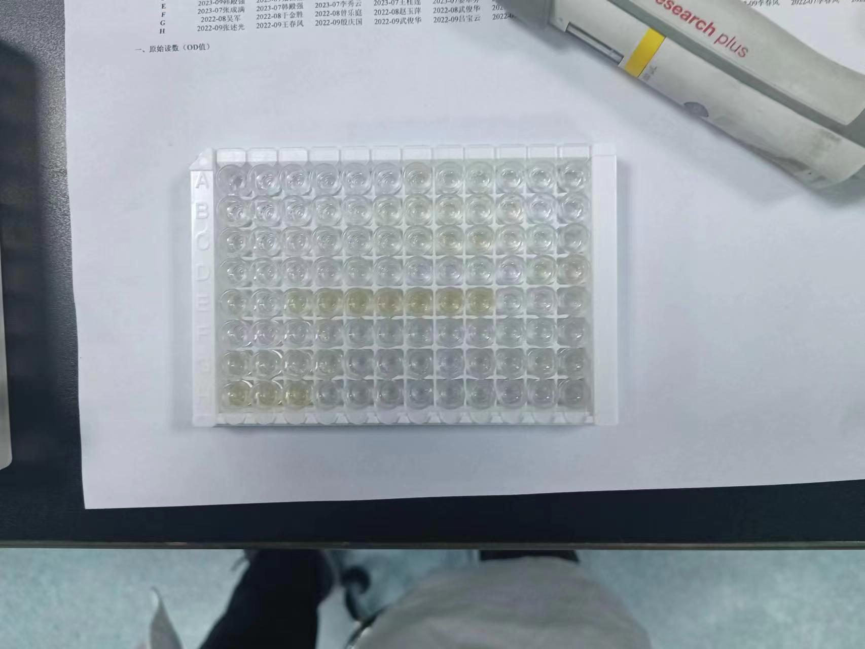 人胃泌素释放肽前体(ProGRP)ELISA试剂盒