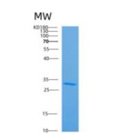 人载脂蛋白A-1重组蛋白