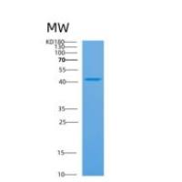 人APOL4重组蛋白