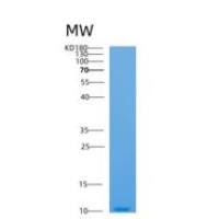 人载脂蛋白C1(APOC1)重组蛋白