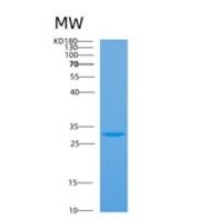 人酸性核磷蛋白32A(ANP32A)重组蛋白