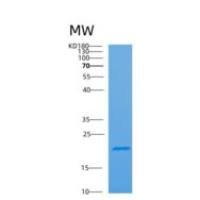 人腺嘌呤磷酸核糖转移酶(APRT)重组蛋白