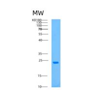 人天冬氨酸β羟化酶(ASPH)重组蛋白
