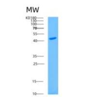 人AS3MT重组蛋白