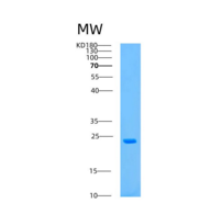 人天冬氨酸β羟化酶(ASPH)重组蛋白
