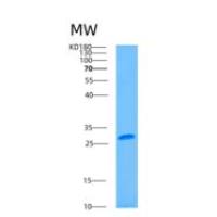 人去唾液酸糖蛋白受体2(ASGR2)重组蛋白