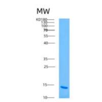 人ARSM2重组蛋白