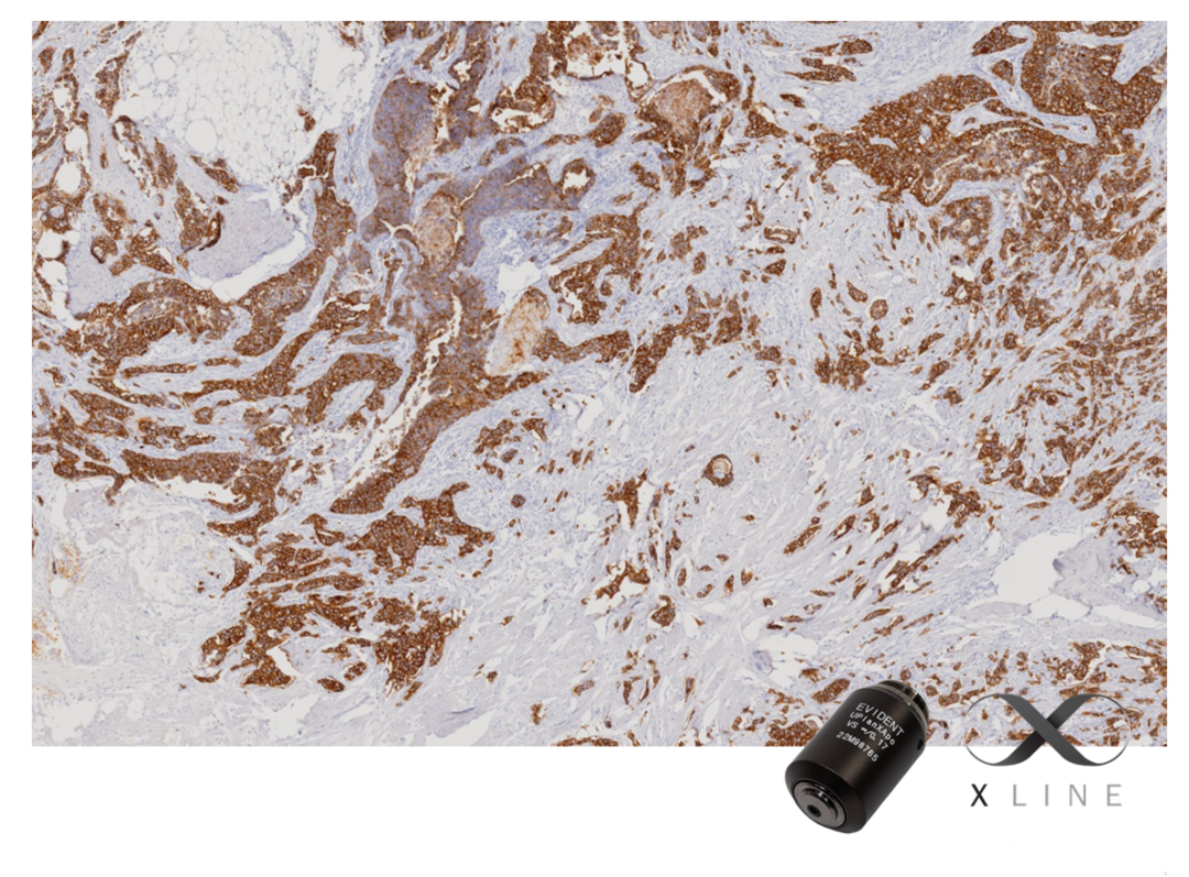 新品发布丨SLIDEVIEW VS-M1R全玻片扫描系统重磅来袭!