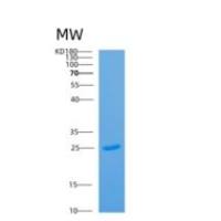 人ADP核糖基化因子样蛋白15(ARL15)重组蛋白
