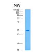 人ASRGL1重组蛋白