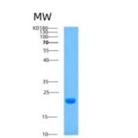 人肌动蛋白相关蛋白2/3复合物亚单位5重组蛋白