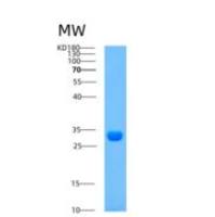 人肌动蛋白相关蛋白2/3复合物亚单位3重组蛋白