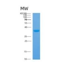 人膜联蛋白A4(ANXA4)重组蛋白