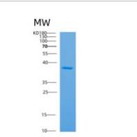 人脱嘌呤/脱嘧啶核酸内切酶1(APEX1)重组蛋白