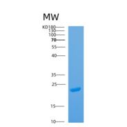 人ARL14重组蛋白