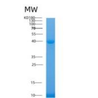 人醛缩酶A重组蛋白
