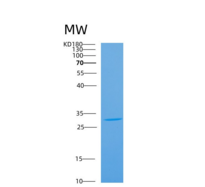 小鼠炭疽热毒素受体2(ANTXR2)重组蛋白重组蛋白