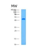人ASCC1重组蛋白
