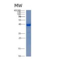 人果糖二磷酸醛缩酶C(ALDOC)重组蛋白