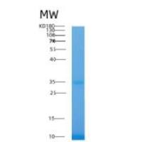 人醛糖还原酶重组蛋白