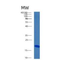 人骨形成蛋白8B(BMP8B)重组蛋白