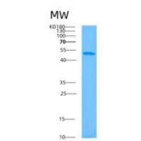 人HLA-B关联转录因子1(BAT1)重组蛋白