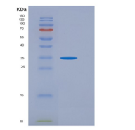人转录激活因子4(ATF4)重组蛋白