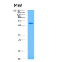 人ATG4B重组蛋白