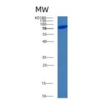 人核因子κB激酶抑制因子相互作用蛋白(IKBIP)重组蛋白