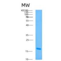 人氢离子转运ATP酶线粒体F1复合体δ肽(ATP5d)重组蛋白