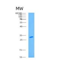 人钠/钾离子转运ATP酶β1肽(ATP1b1)重组蛋白